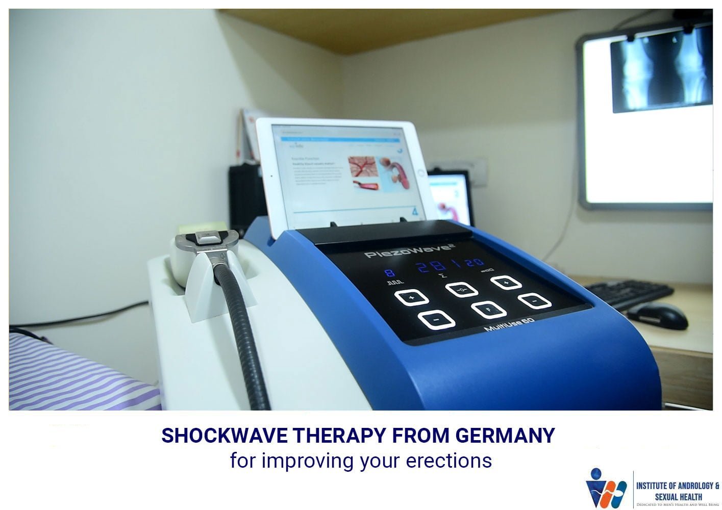 Shockwave Therapy From Germany for improving your Erections