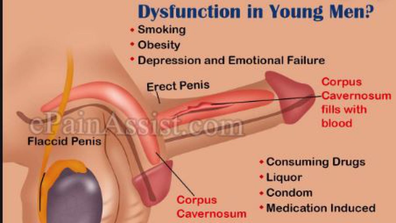 Erectile Dysfunction Causes in Young Adult