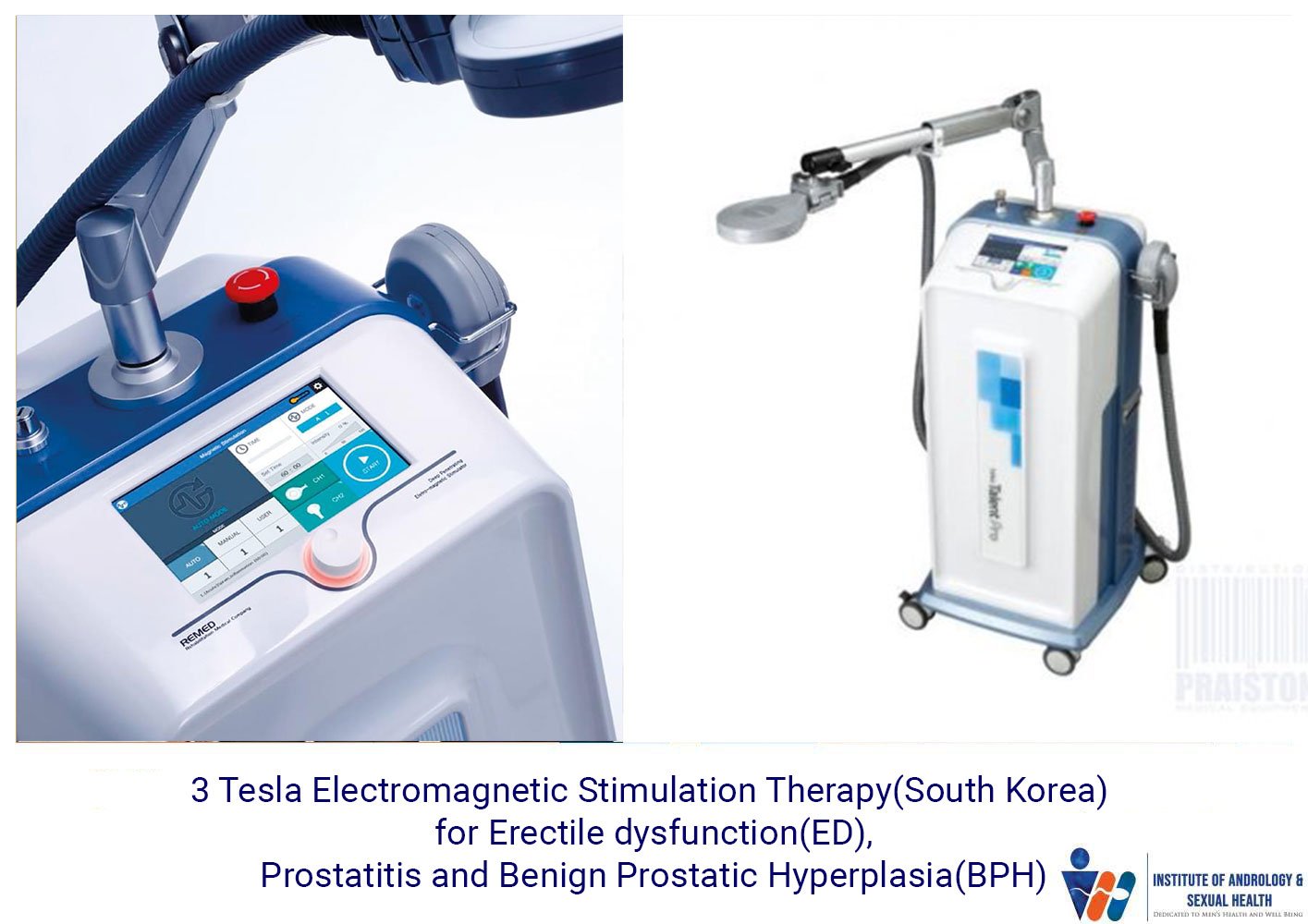 3 Tesla Electromagnetic Stimulation Therapy(South Korea) for Erectile dysfunction(ED), Prostatitis and Benign Prostatic Hyperplasia(BPH)