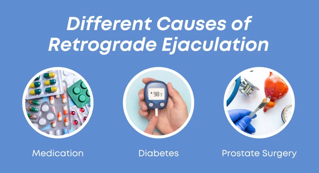 Different Causes of Retrograde Ejaculation